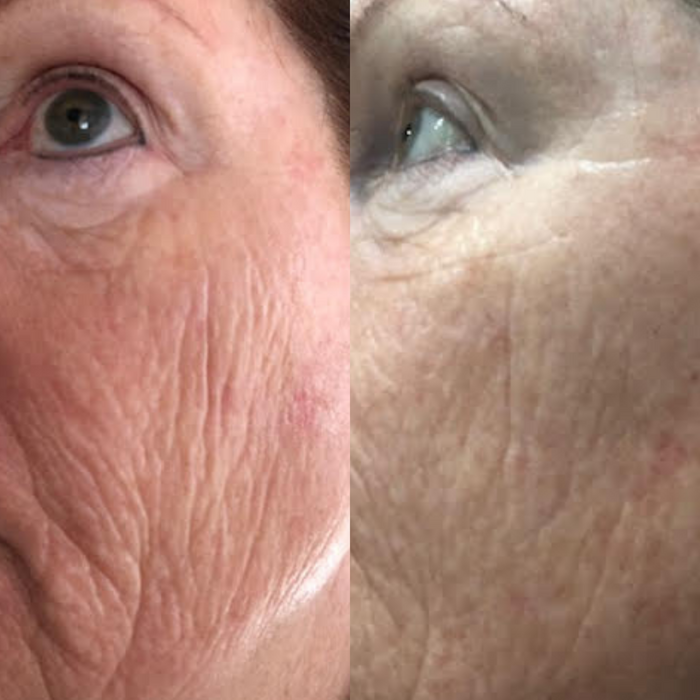 Sea Cucumber Collagen Anti-Ageing Cream