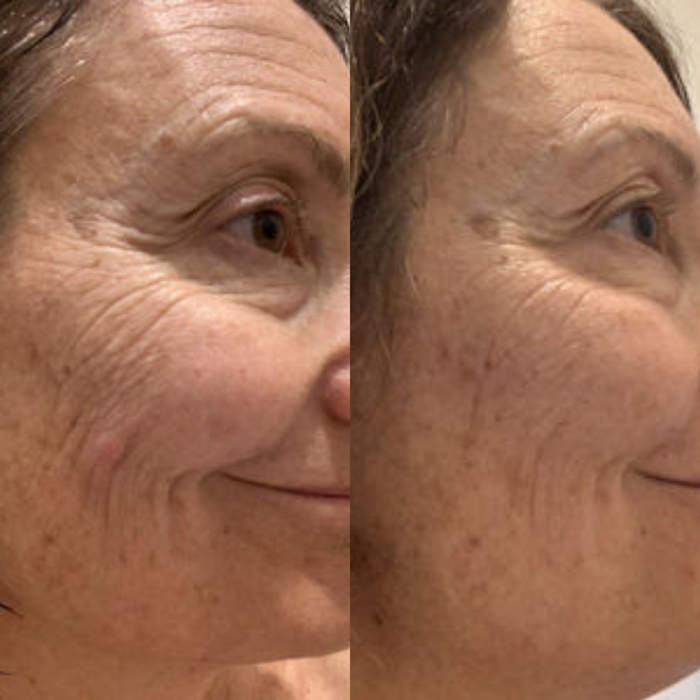 Sea Cucumber Collagen Anti-Ageing Cream