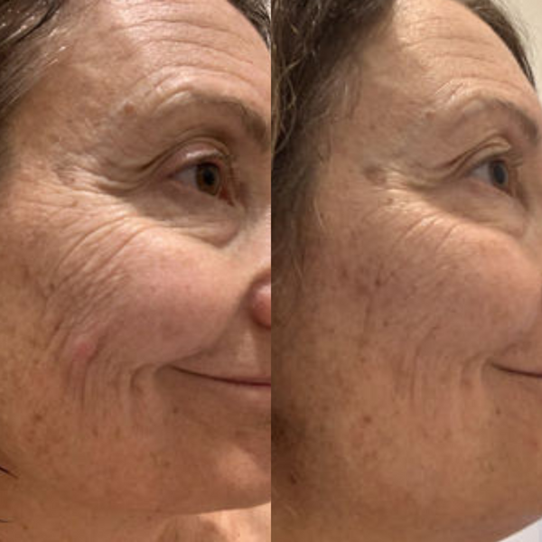 Sea Cucumber Collagen Anti-Ageing Cream