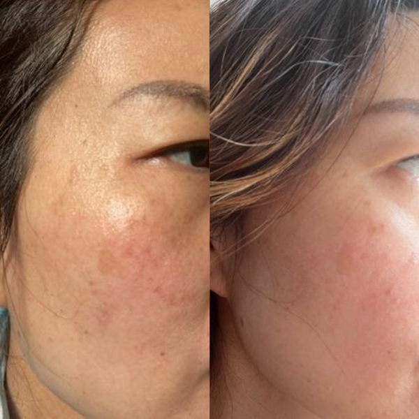 Sea Cucumber Collagen Day & Night Pack