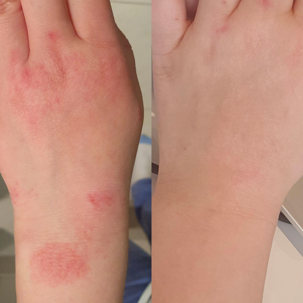 Sea Cucumber Collagen Sensitive Skin Pack