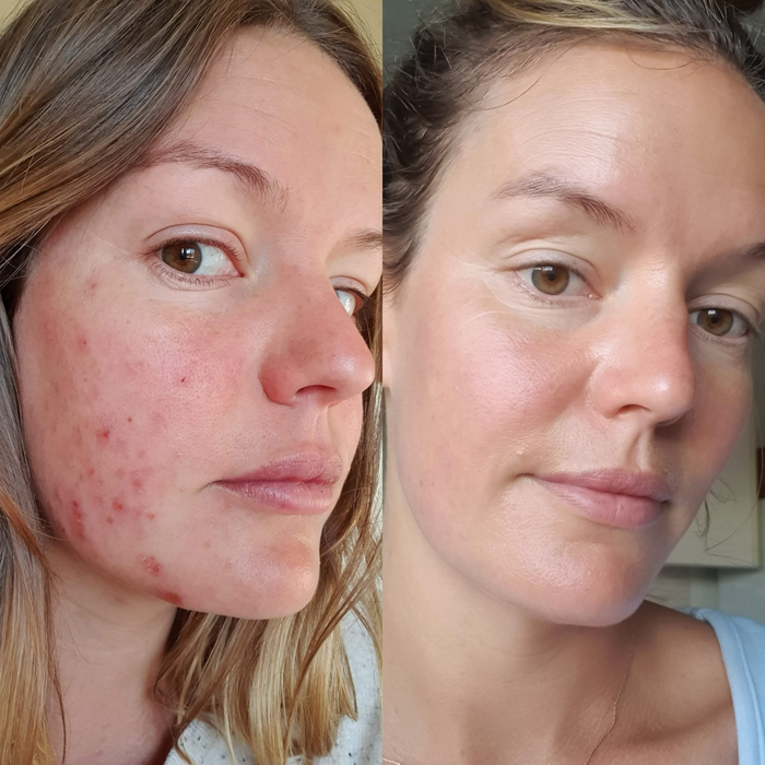 Sea Cucumber Collagen Anti-Ageing Cream