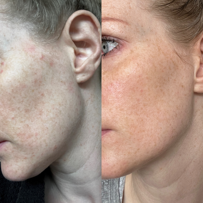 Sea Cucumber Collagen Anti-Ageing Cream