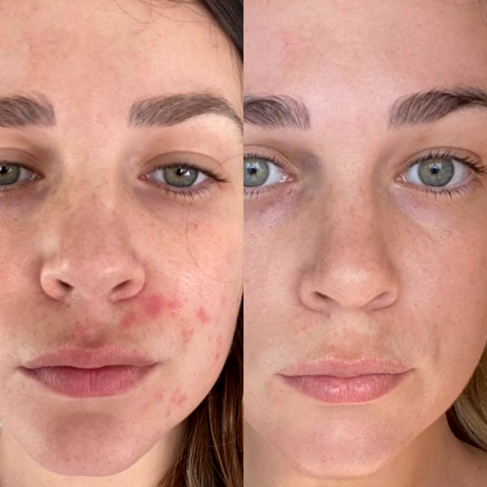 Sea Cucumber Collagen Sensitive Skin Pack