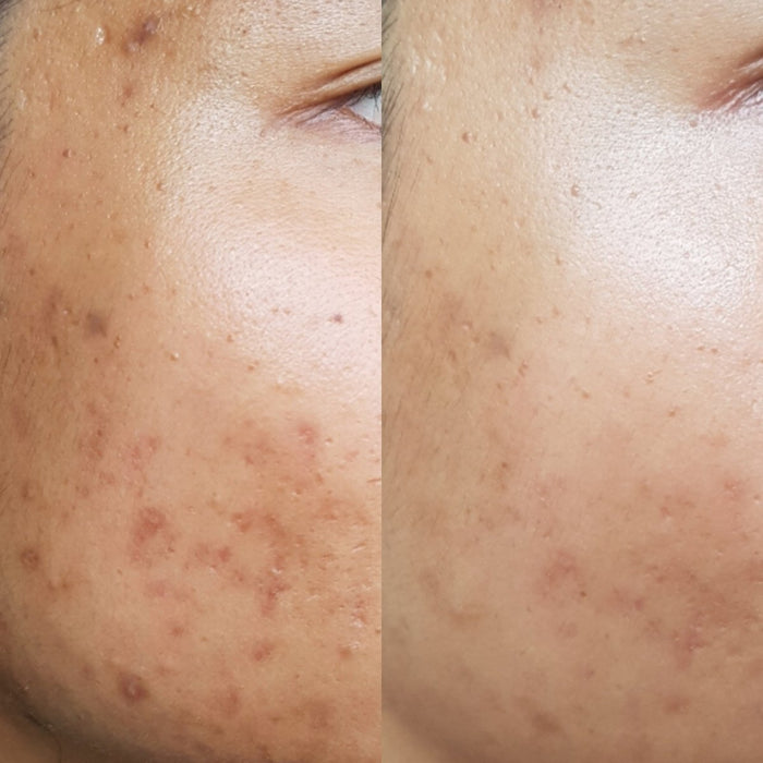 Sea Cucumber Collagen Brightening & Pigmentation Pack