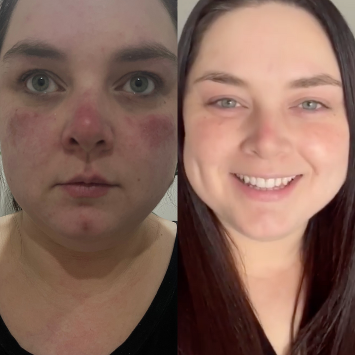 Sea Cucumber Collagen Sensitive Skin Pack