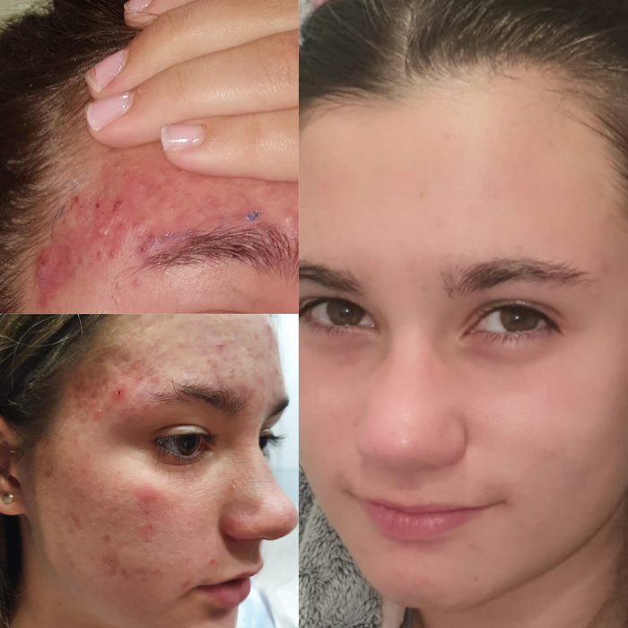 Sea Cucumber Collagen Sensitive Skin Pack