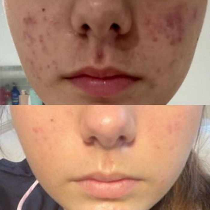 Sea Cucumber Collagen Sensitive Skin Pack
