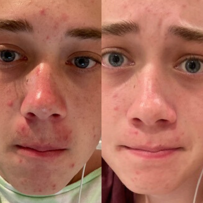 Sea Cucumber Collagen Sensitive Skin Pack