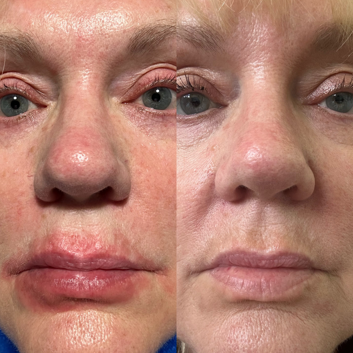 Sea Cucumber Collagen Sensitive Skin Pack