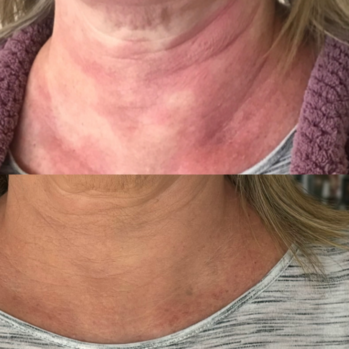 Sea Cucumber Collagen Sensitive Skin Pack
