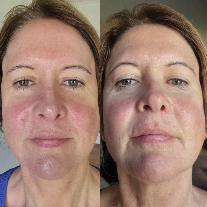 Sea Cucumber Collagen Trio Pack