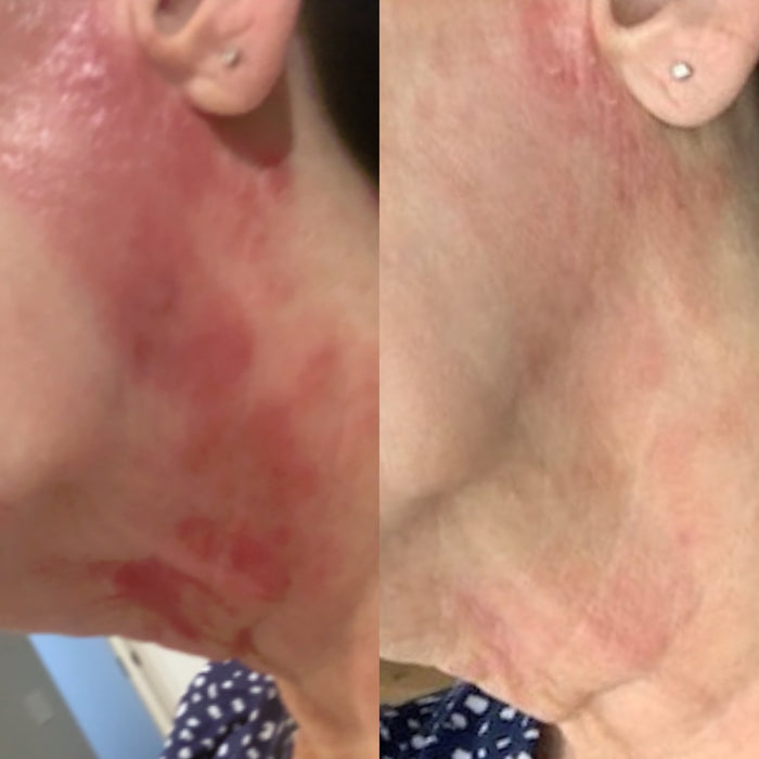 Sea Cucumber Collagen Sensitive Skin Pack