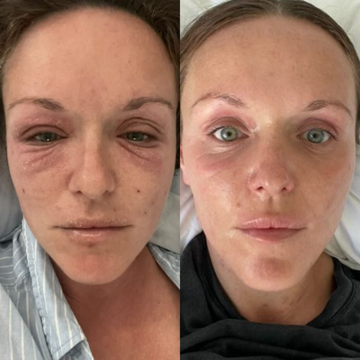 Sea Cucumber Collagen Sensitive Skin Pack