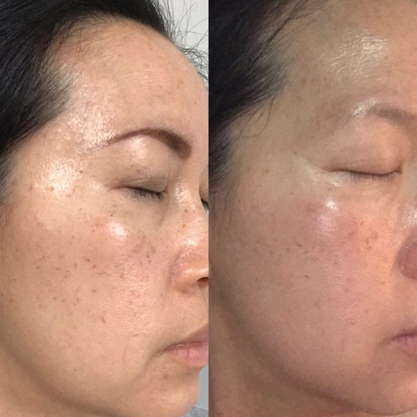 Sea Cucumber Collagen Brightening & Pigmentation Pack