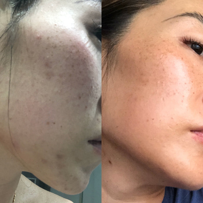 Sea Cucumber Collagen Brightening Balance Serum