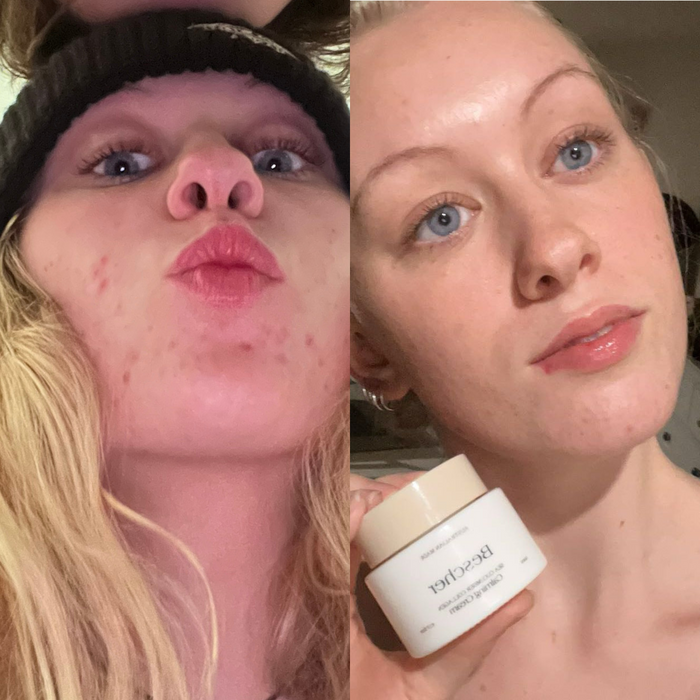 Sea Cucumber Collagen Sensitive Skin Pack