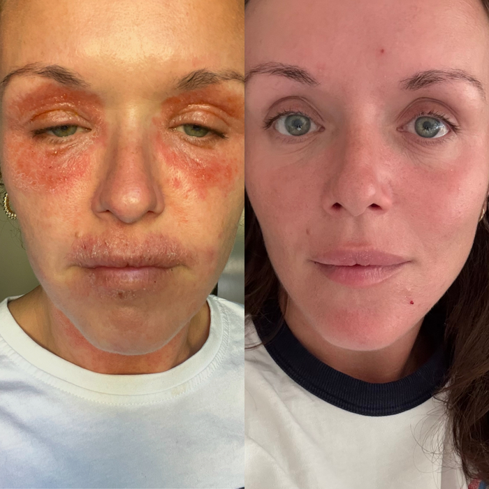 Sea Cucumber Collagen Sensitive Skin Pack